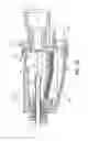 Fig. 07 - BIOPSY PROBE HAVING A TISSUE SPECIMEN COLLECTOR