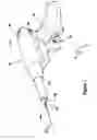 Fig. 02 - Tissue excision device
