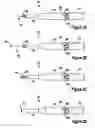 Fig. 03 - Tissue excision device with rotating stylet blades