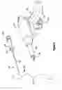 Fig. 04 - Tissue excision device with rotating stylet blades