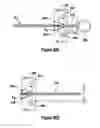 Fig. 32 - Tissue excision device