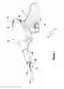 Fig. 02 - Tissue excision device with a retractable backhook