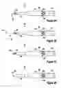 Fig. 03 - Tissue excision device with a flexible transection blade
