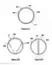 Fig. 23 - Tissue excision device with a flexible transection blade