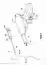 Fig. 04 - Tissue excision device with a retracting stylet blade
