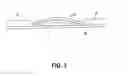 Fig. 04 - Transdermal integrated actuator device, methods of making and using same