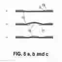 Fig. 09 - Transdermal integrated actuator device, methods of making and using same
