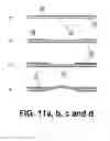 Fig. 12 - Transdermal integrated actuator device, methods of making and using same