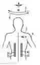 Fig. 01 - Methods and devices for measuring a torsion of a part of the body