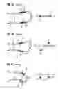 Fig. 02 - Methods and devices for measuring a torsion of a part of the body