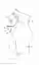Fig. 01 - FETAL STIMULATION DEVICE