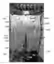 Fig. 01 - Wearable cable-driven exoskeleton for functional arm training