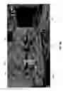 Fig. 08 - Wearable cable-driven exoskeleton for functional arm training