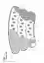 Fig. 02 - Compression garment having an extension