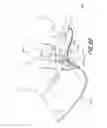 Fig. 13 - FLEXIBLE MEDICAL BARRIER SYSTEMS AND METHODS OF USE