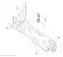 Fig. 14 - FLEXIBLE MEDICAL BARRIER SYSTEMS AND METHODS OF USE