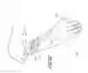 Fig. 16 - FLEXIBLE MEDICAL BARRIER SYSTEMS AND METHODS OF USE