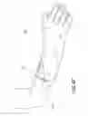 Fig. 17 - FLEXIBLE MEDICAL BARRIER SYSTEMS AND METHODS OF USE