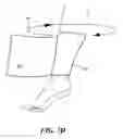Fig. 06 - Compact package for an orthopedic cast