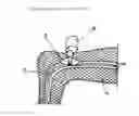 Fig. 01 - MEDICAL CAST AND SKIN PROTECTOR