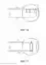 Fig. 10 - Methods and devices for percutaneous and surgical interventions