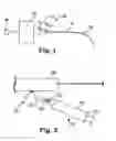 Fig. 02 - Devices, systems and methods for delivering fluid to tissue
