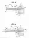 Fig. 04 - Device for delivering medicinal implants