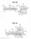 Fig. 05 - Device for delivering medicinal implants