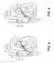 Fig. 04 - Method of using catheter with rotating portion