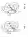 Fig. 05 - Method of using catheter with rotating portion