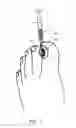 Fig. 08 - Simple device for treating tinea unguium