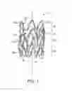 Fig. 02 - Implantable prosthesis with depot retention feature