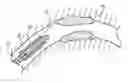 Fig. 01 - Endoprosthesis
