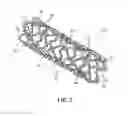 Fig. 03 - Endoprosthesis