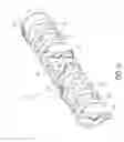 Fig. 07 - Expandable slide and lock stent