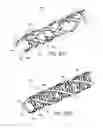 Fig. 37 - Expandable slide and lock stent