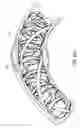 Fig. 53 - Expandable slide and lock stent