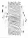 Fig. 02 - Flexible stent