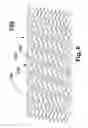 Fig. 07 - Flexible stent