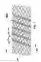 Fig. 08 - Flexible stent