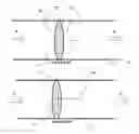 Fig. 04 - Implantable prosthetic device for connection to a fluid flow pathway of a patient