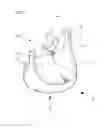Fig. 02 - POLYMER VALVE AND PULSATILE CONDUIT-TYPE VAD USING THE SAME