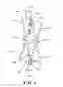 Fig. 06 - Repositionable endoluminal support structure and its applications