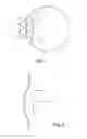 Fig. 02 - ADJUSTABLE INTRAOCULAR LENS SYSTEM