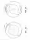 Fig. 09 - Intraocular lens
