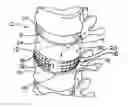 Fig. 01 - Annulus-Reinforcing Band