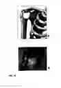 Fig. 19 - METHODS AND COMPOSITIONS FOR JOINT HEALING AND REPAIR