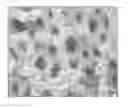 Fig. 01 - POROUS SURFACE LAYERS WITH INCREASED SURFACE ROUGHNESS AND IMPLANTS INCORPORATING THE SAME