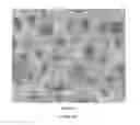 Fig. 02 - POROUS SURFACE LAYERS WITH INCREASED SURFACE ROUGHNESS AND IMPLANTS INCORPORATING THE SAME