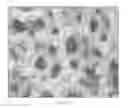 Fig. 03 - POROUS SURFACE LAYERS WITH INCREASED SURFACE ROUGHNESS AND IMPLANTS INCORPORATING THE SAME